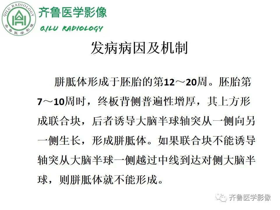影像PPT - 【病例】胼胝体发育不良2例影像诊断-13