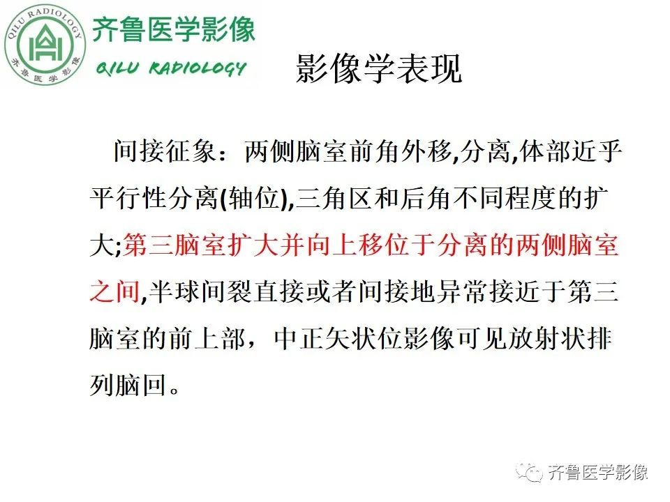 影像PPT - 【病例】胼胝体发育不良2例影像诊断-16
