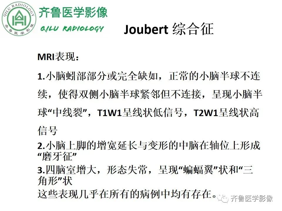 影像PPT - 【病例】胼胝体发育不良2例影像诊断-29