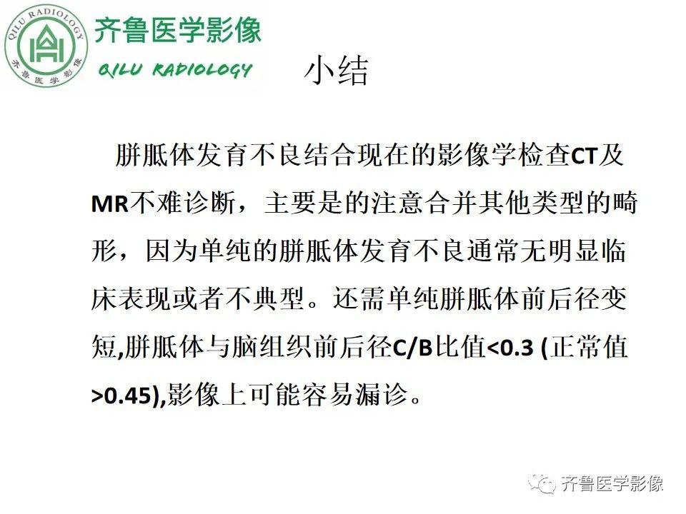 影像PPT - 【病例】胼胝体发育不良2例影像诊断-39