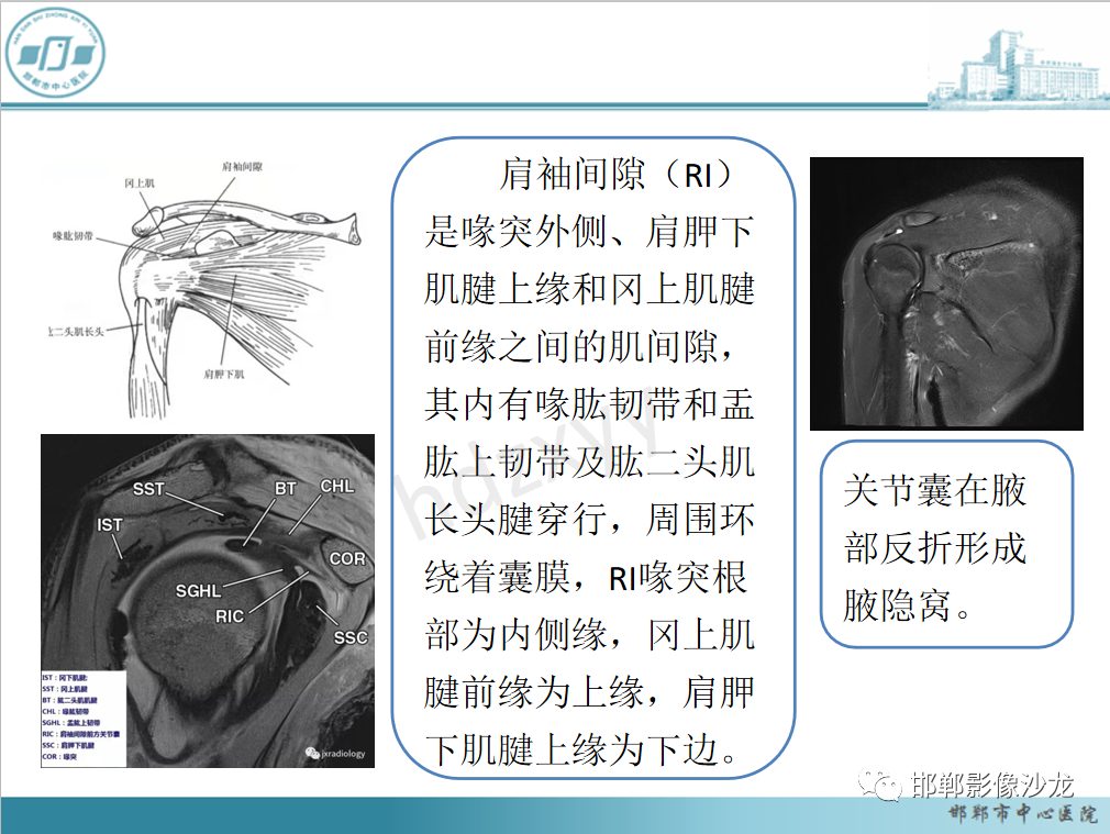 影像PPT - 【PPT】肩周炎和肩袖损伤的鉴别-8