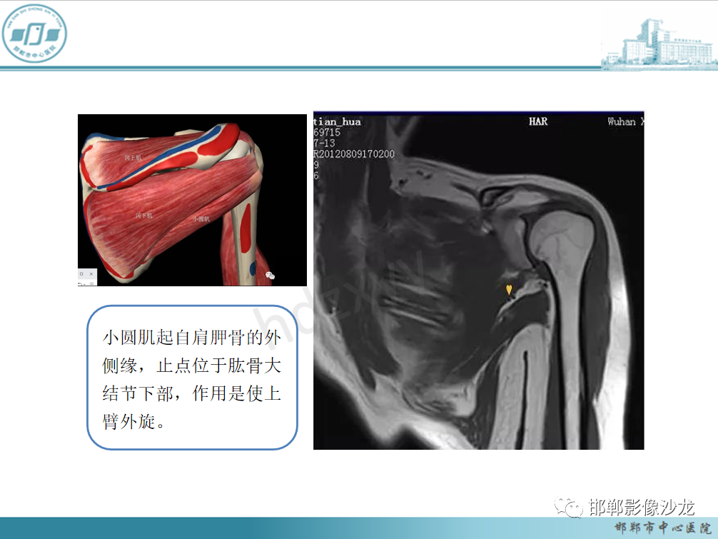 影像PPT - 【PPT】肩周炎和肩袖损伤的鉴别-18