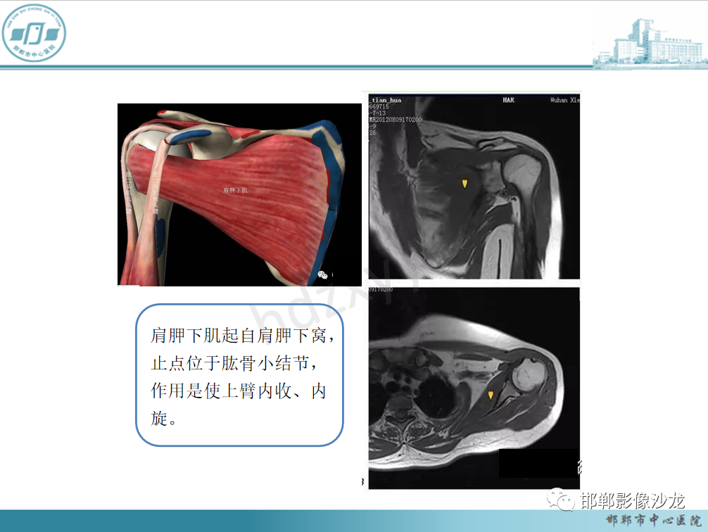 影像PPT - 【PPT】肩周炎和肩袖损伤的鉴别-19