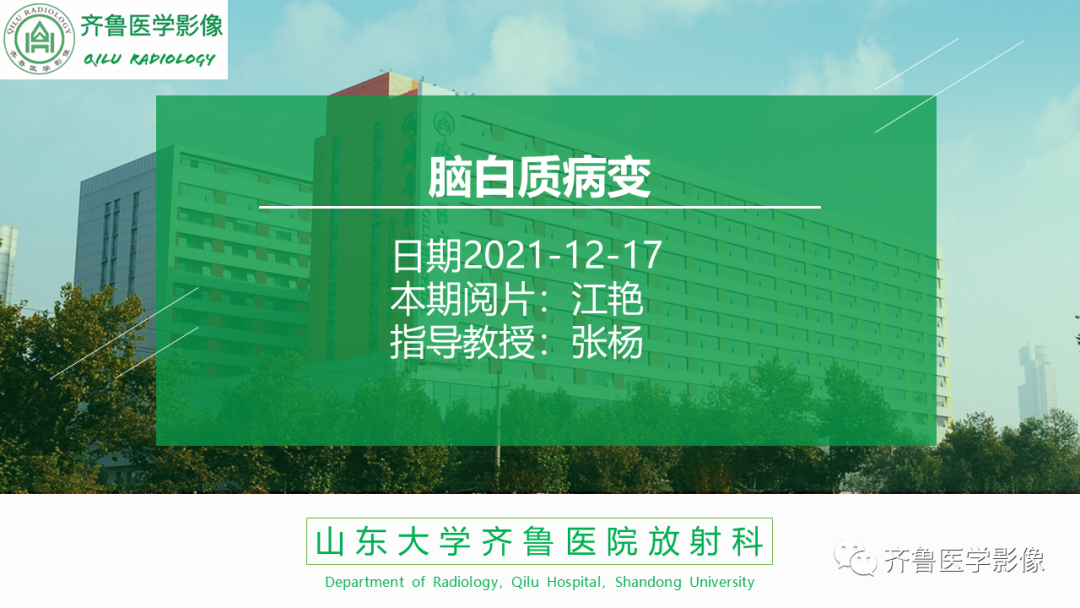 影像PPT - 【PPT】可逆性后部脑病综合征PRES二例影像-1