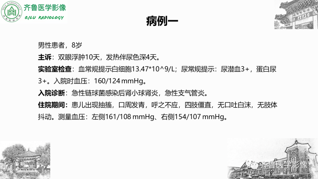 影像PPT - 【PPT】可逆性后部脑病综合征PRES二例影像-2