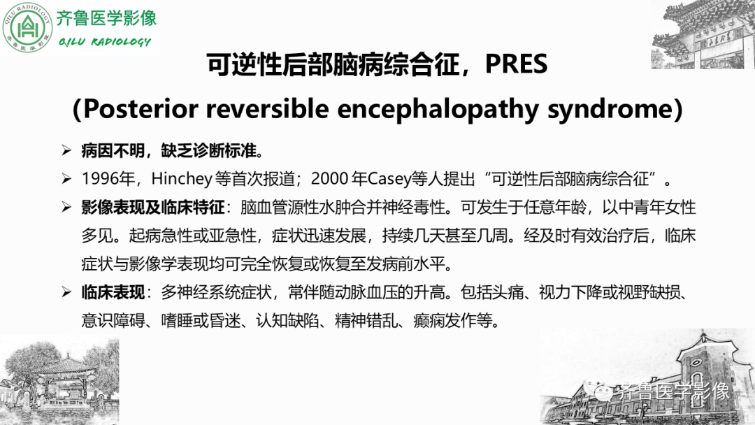影像PPT - 【PPT】可逆性后部脑病综合征PRES二例影像-17