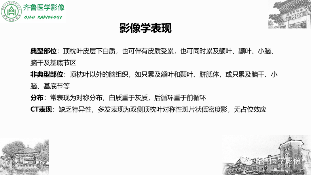 影像PPT - 【PPT】可逆性后部脑病综合征PRES二例影像-20