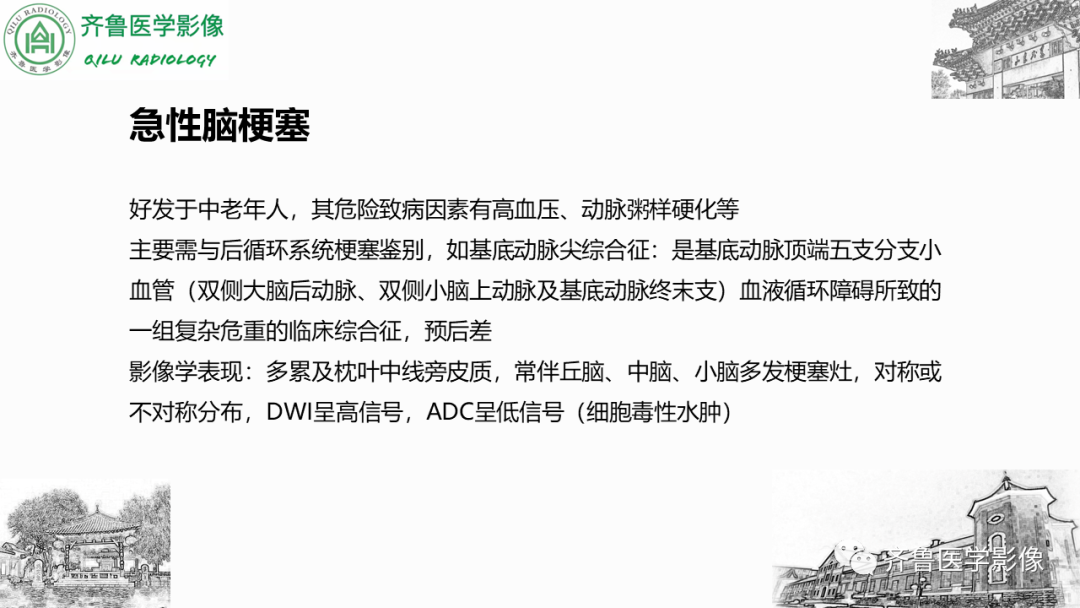 影像PPT - 【PPT】可逆性后部脑病综合征PRES二例影像-30