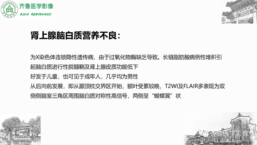 影像PPT - 【PPT】可逆性后部脑病综合征PRES二例影像-36