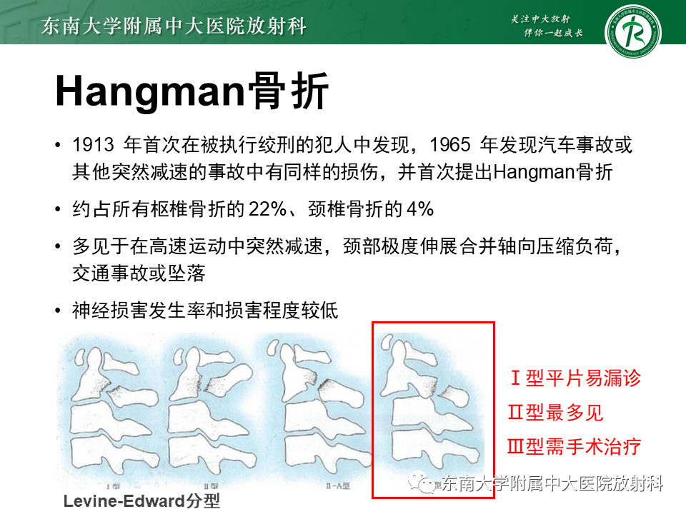 影像PPT - 【PPT】上颈椎骨折影像学评估-19 影像PPT - 【PPT】上颈椎骨折影像学评估-19