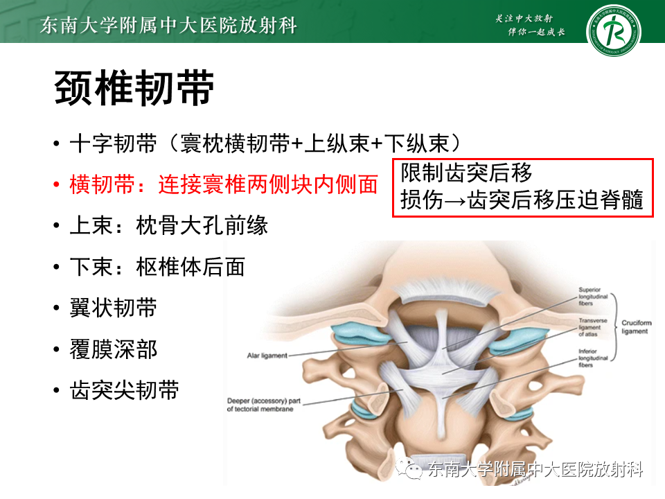 影像PPT - 【PPT】上颈椎骨折影像学评估-21 影像PPT - 【PPT】上颈椎骨折影像学评估-21