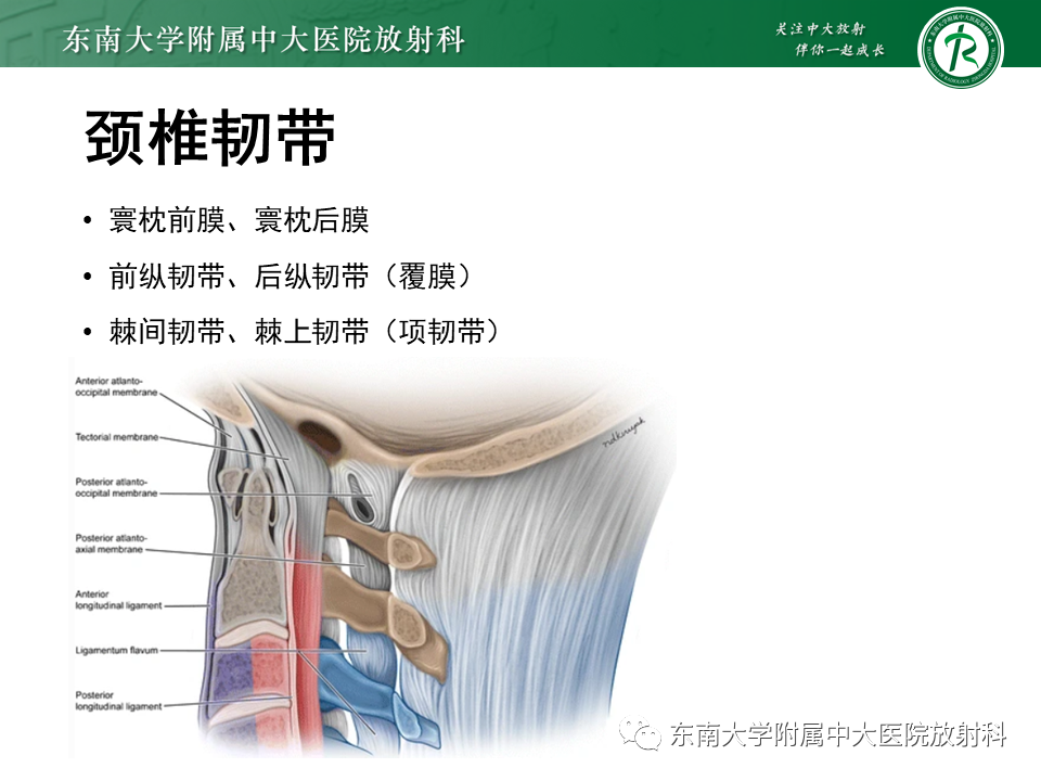 影像PPT - 【PPT】上颈椎骨折影像学评估-22 影像PPT - 【PPT】上颈椎骨折影像学评估-22