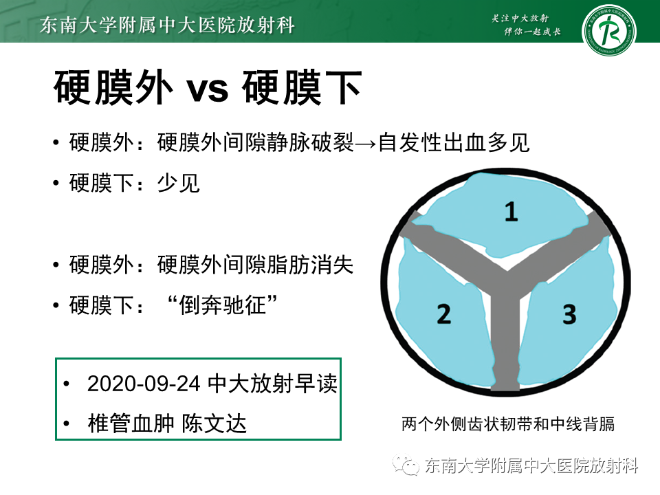 影像PPT - 【PPT】上颈椎骨折影像学评估-30 影像PPT - 【PPT】上颈椎骨折影像学评估-30