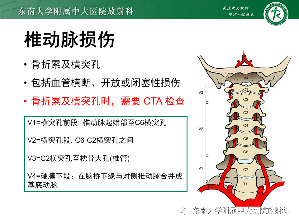 影像PPT - 【PPT】上颈椎骨折影像学评估-31 影像PPT - 【PPT】上颈椎骨折影像学评估-31