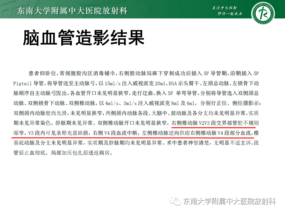影像PPT - 【PPT】上颈椎骨折影像学评估-33 影像PPT - 【PPT】上颈椎骨折影像学评估-33