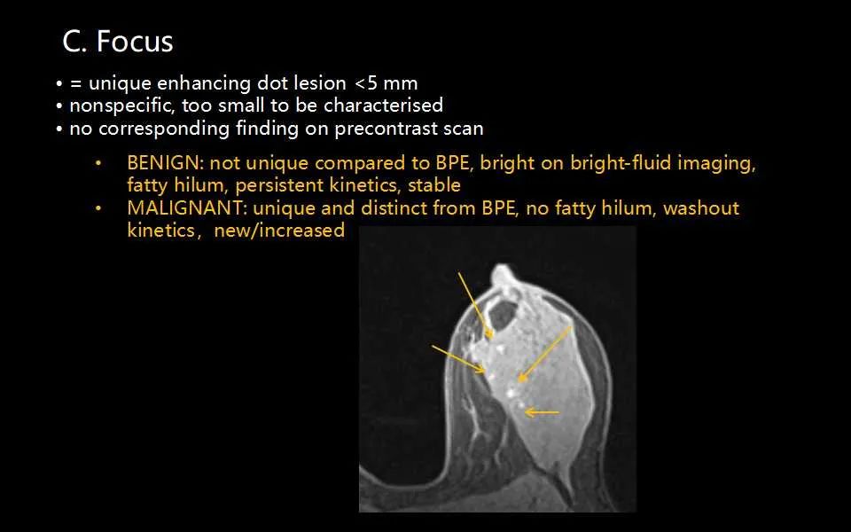 影像PPT - 【PPT】解读乳腺磁共振成像：ACR BI-RADS MRI报告词汇及图片回顾-13