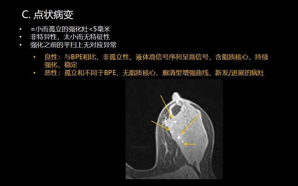 影像PPT - 【PPT】解读乳腺磁共振成像：ACR BI-RADS MRI报告词汇及图片回顾-14