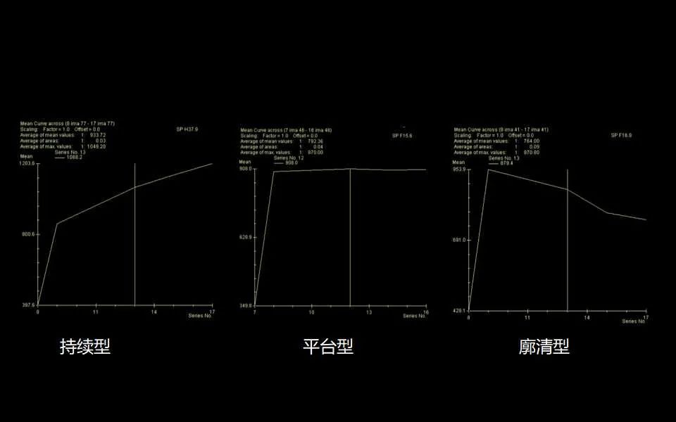 影像PPT - 【PPT】解读乳腺磁共振成像：ACR BI-RADS MRI报告词汇及图片回顾-52