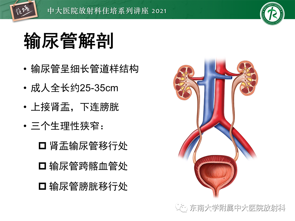 影像PPT - 【PPT】输尿管扩张性疾病的影像诊断-2