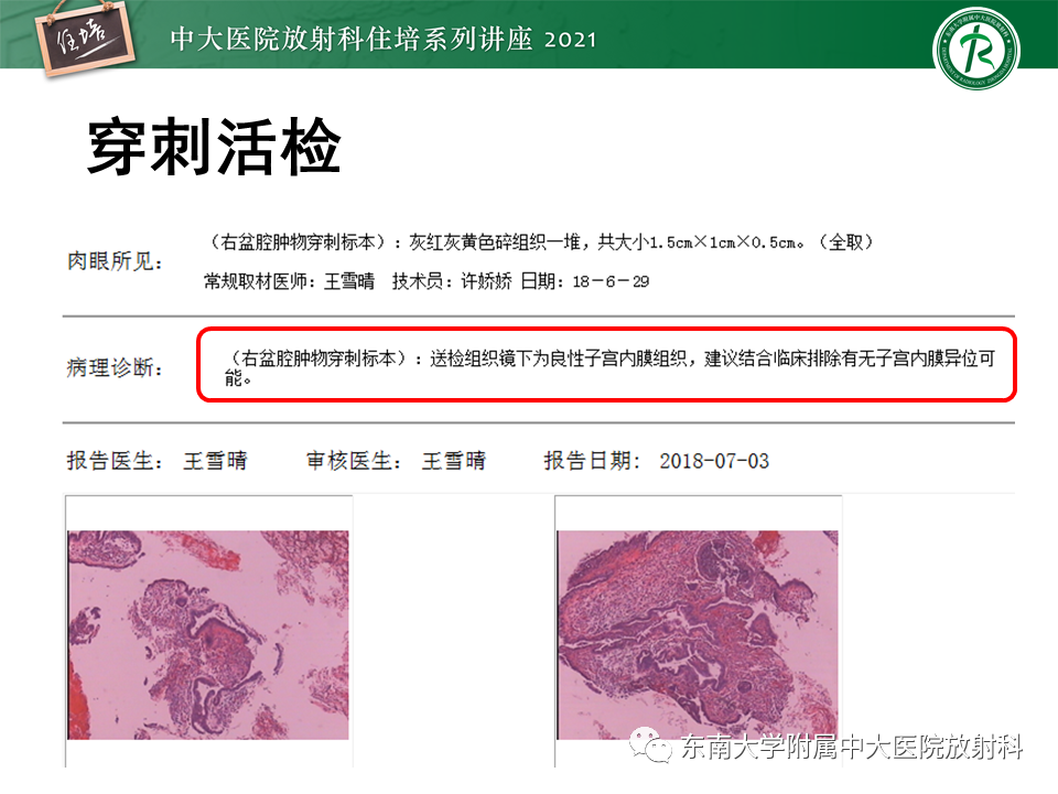 影像PPT - 【PPT】输尿管扩张性疾病的影像诊断-6