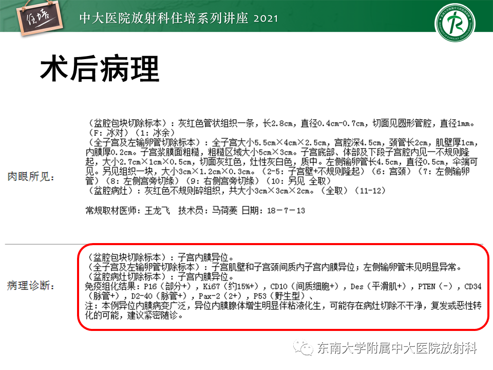 影像PPT - 【PPT】输尿管扩张性疾病的影像诊断-7