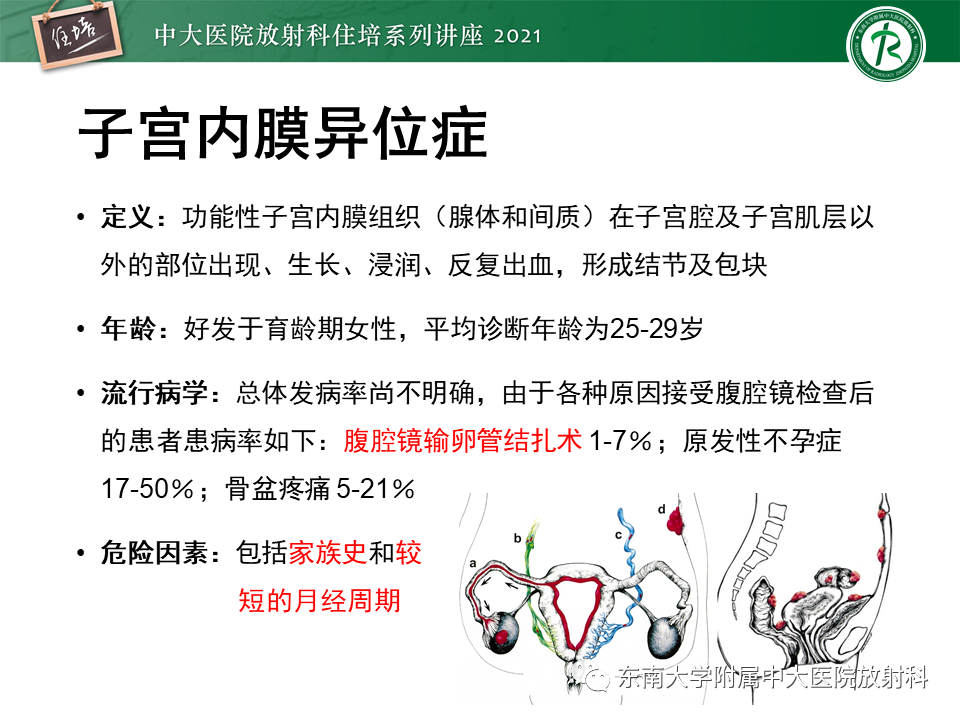 影像PPT - 【PPT】输尿管扩张性疾病的影像诊断-8
