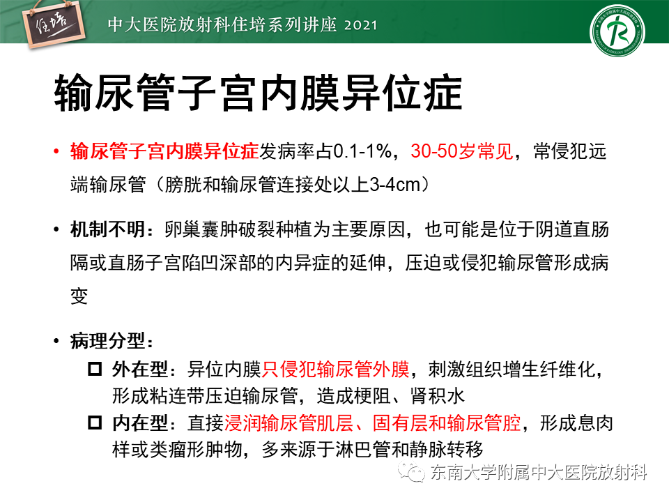 影像PPT - 【PPT】输尿管扩张性疾病的影像诊断-10