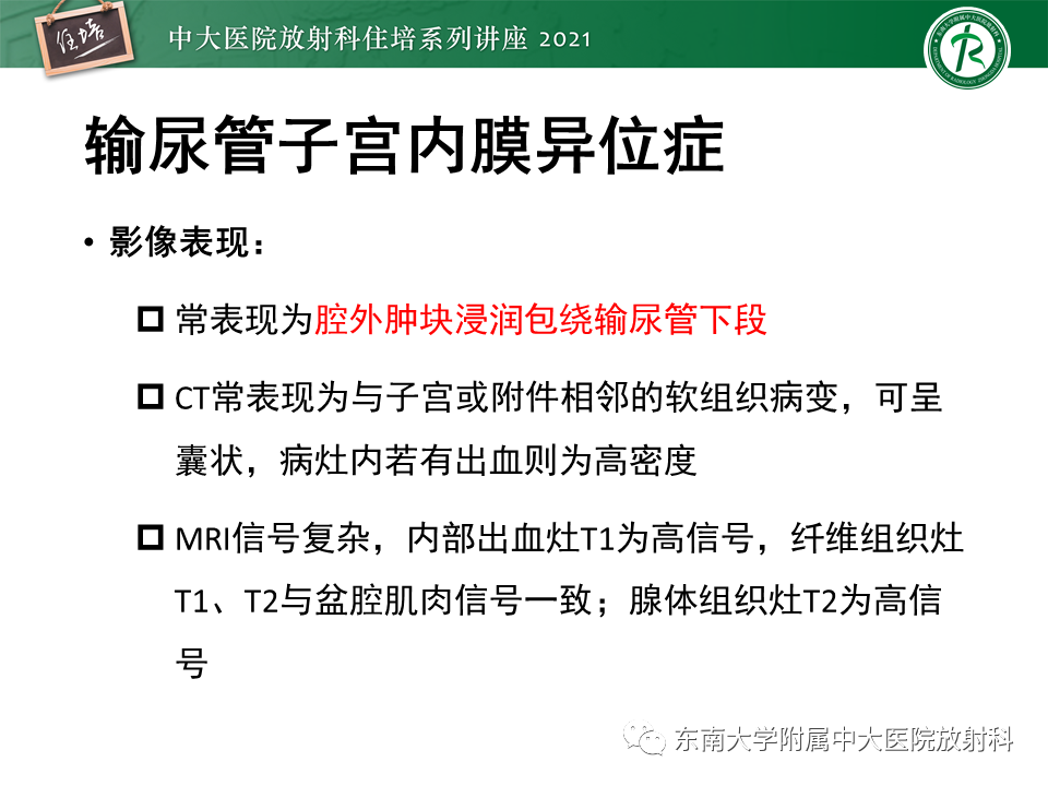 影像PPT - 【PPT】输尿管扩张性疾病的影像诊断-11
