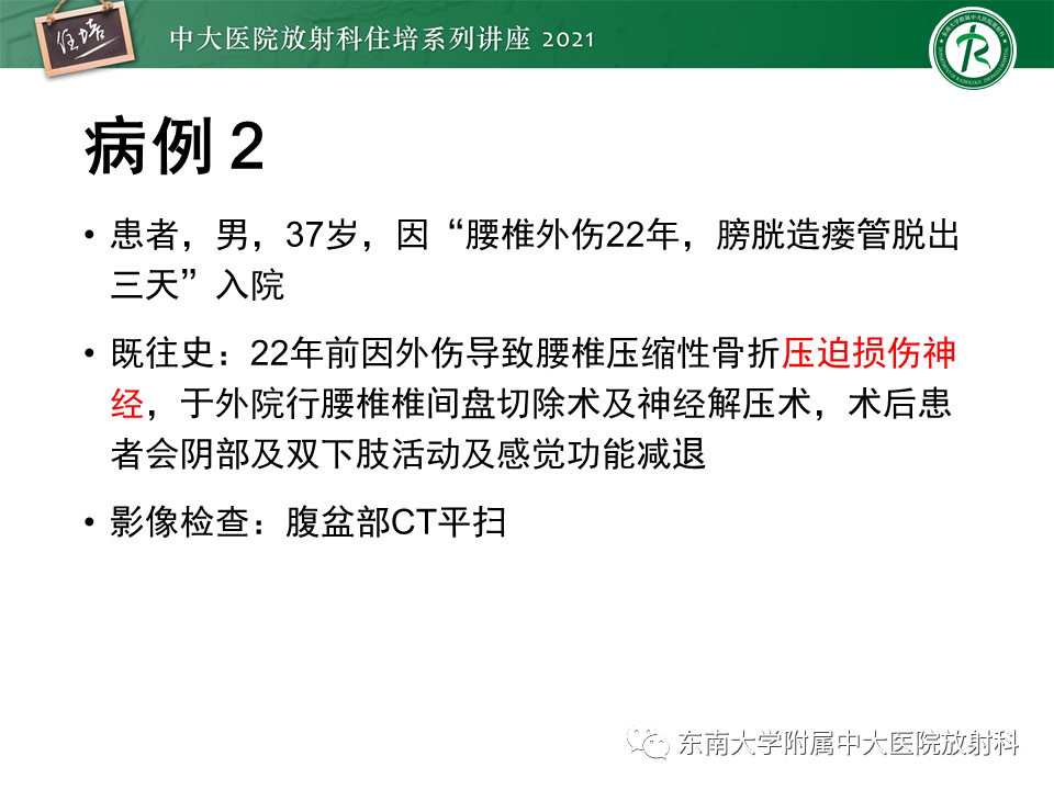 影像PPT - 【PPT】输尿管扩张性疾病的影像诊断-13