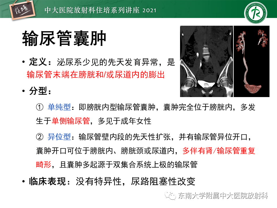 影像PPT - 【PPT】输尿管扩张性疾病的影像诊断-20