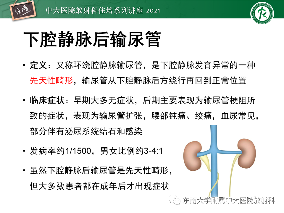 影像PPT - 【PPT】输尿管扩张性疾病的影像诊断-24