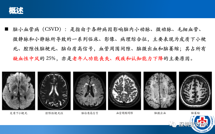 影像PPT - 【PPT】脑小血管病神经影像评估-3