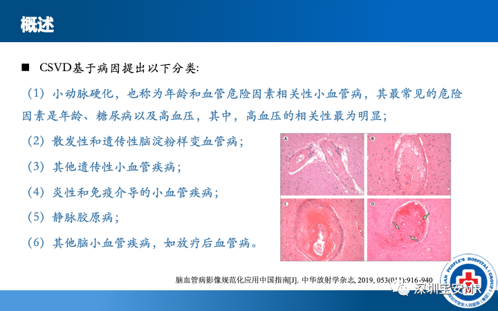 影像PPT - 【PPT】脑小血管病神经影像评估-4