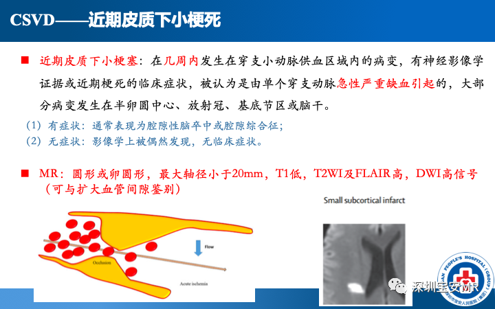 影像PPT - 【PPT】脑小血管病神经影像评估-10