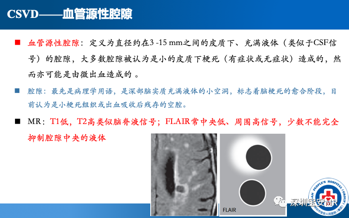 影像PPT - 【PPT】脑小血管病神经影像评估-17