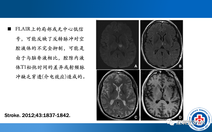 影像PPT - 【PPT】脑小血管病神经影像评估-19