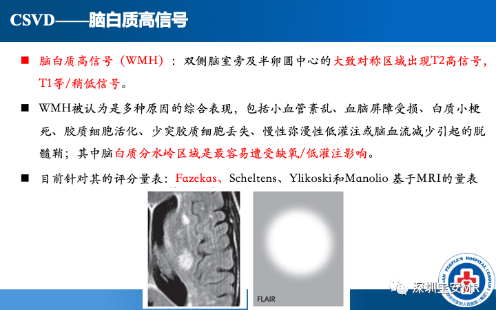 影像PPT - 【PPT】脑小血管病神经影像评估-20