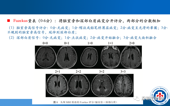 影像PPT - 【PPT】脑小血管病神经影像评估-21