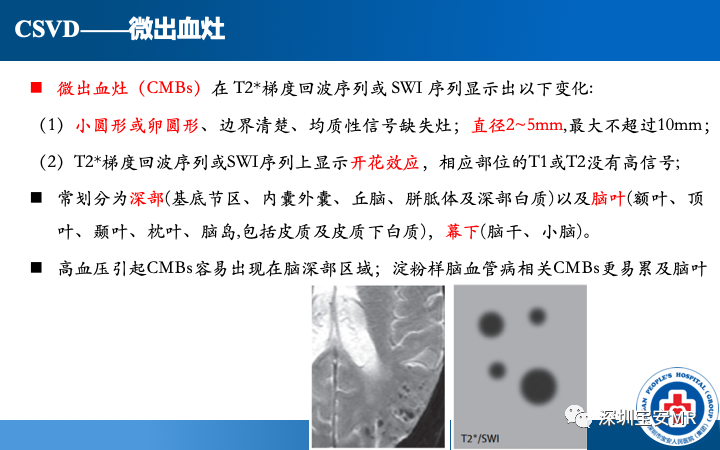 影像PPT - 【PPT】脑小血管病神经影像评估-23