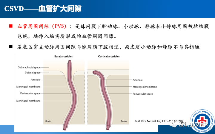 影像PPT - 【PPT】脑小血管病神经影像评估-27