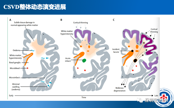 影像PPT - 【PPT】脑小血管病神经影像评估-38