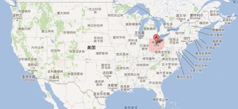 影像PPT - 颈内动脉走形:概述及颈段、岩段和破裂孔段-10 影像PPT - 颈内动脉走形:概述及颈段、岩段和破裂孔段-10