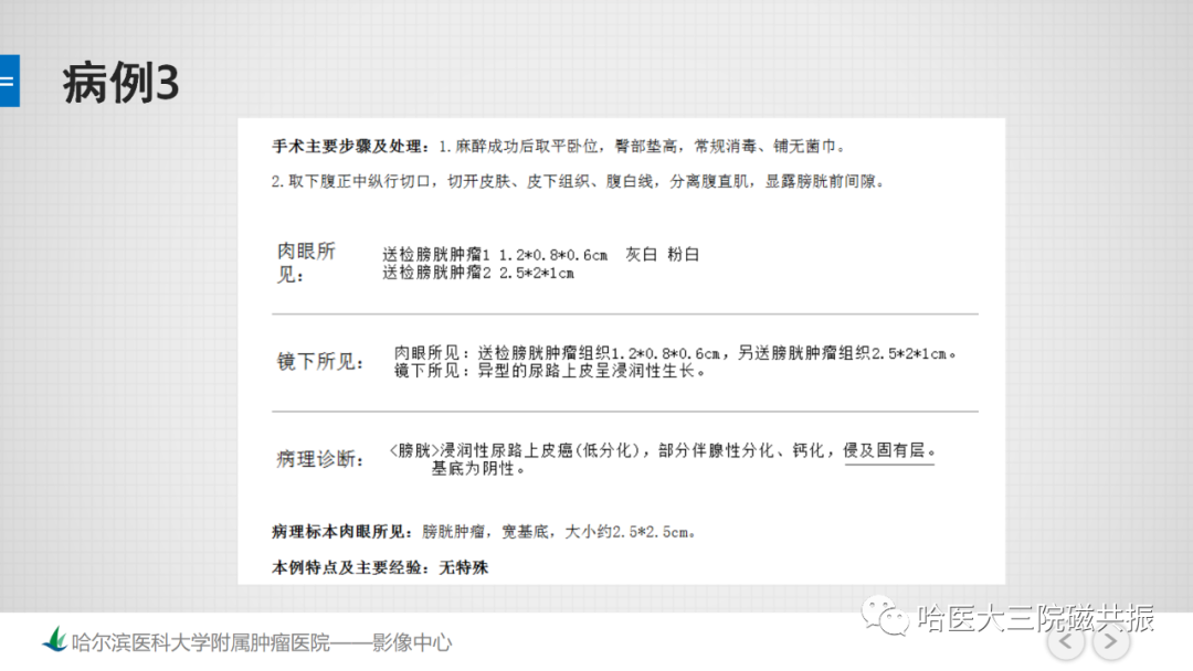 影像PPT - 【PPT】膀胱误诊病例及膀胱癌报告书写规范-20