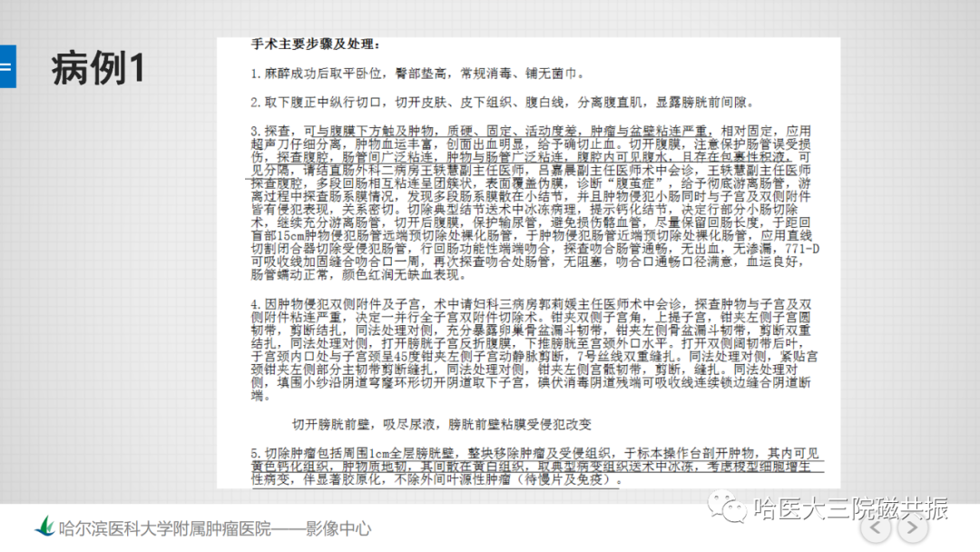 影像PPT - 【PPT】膀胱误诊病例及膀胱癌报告书写规范-4