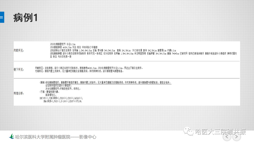 影像PPT - 【PPT】膀胱误诊病例及膀胱癌报告书写规范-5