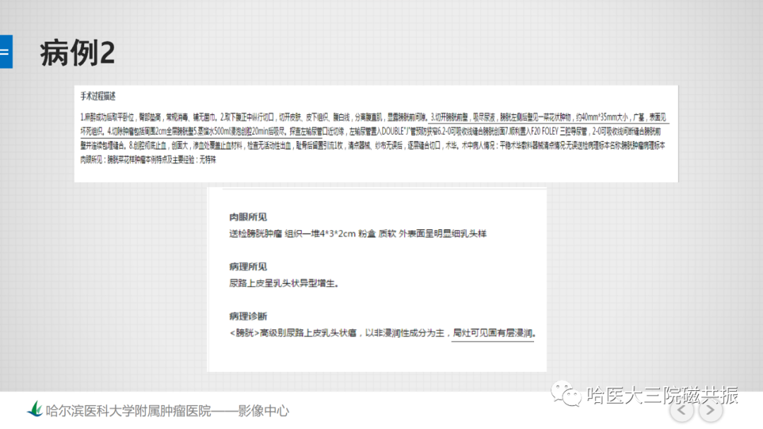 影像PPT - 【PPT】膀胱误诊病例及膀胱癌报告书写规范-8