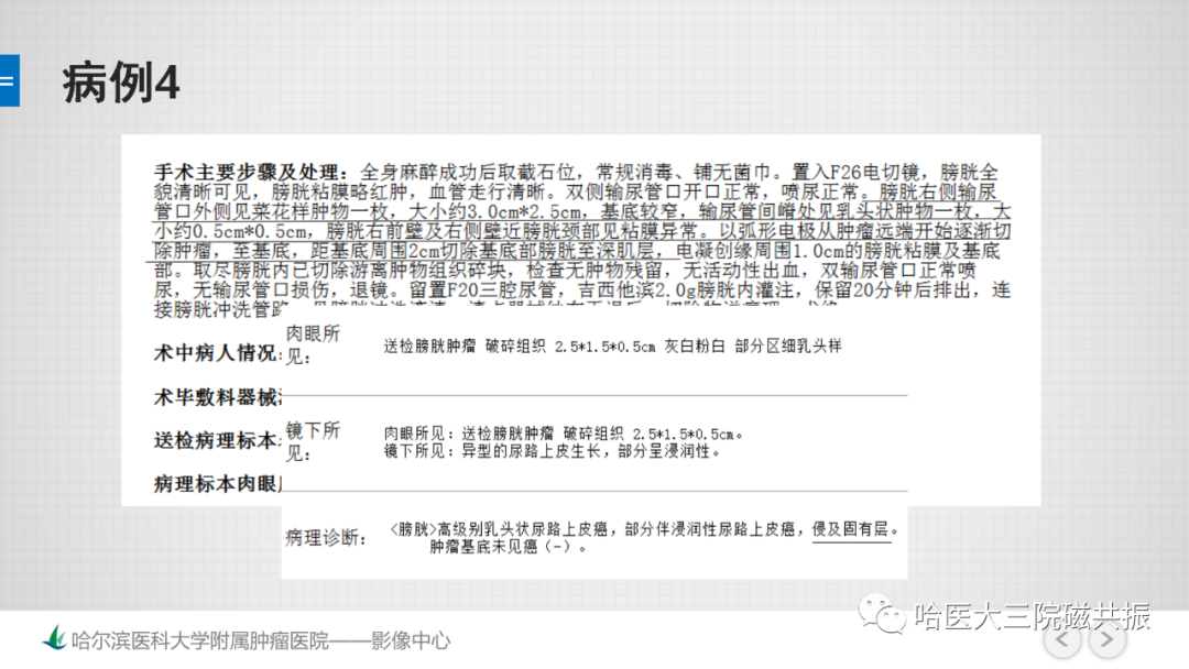 影像PPT - 【PPT】膀胱误诊病例及膀胱癌报告书写规范-12