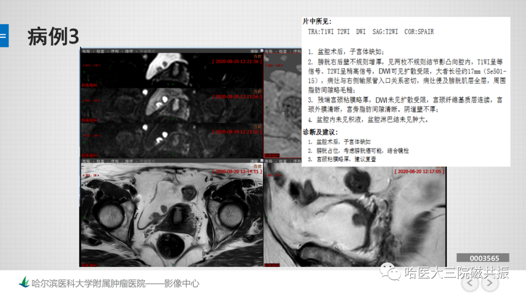 影像PPT - 【PPT】膀胱误诊病例及膀胱癌报告书写规范-10