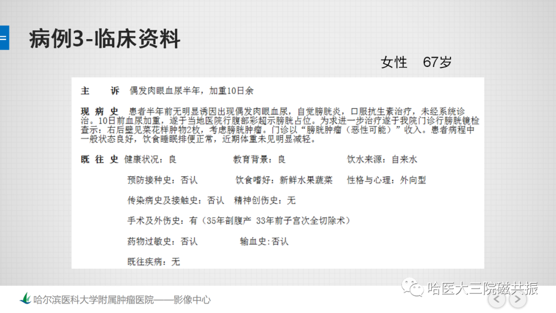 影像PPT - 【PPT】膀胱误诊病例及膀胱癌报告书写规范-9
