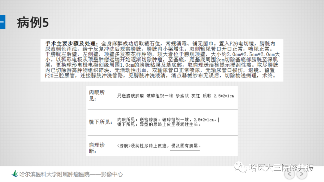 影像PPT - 【PPT】膀胱误诊病例及膀胱癌报告书写规范-15